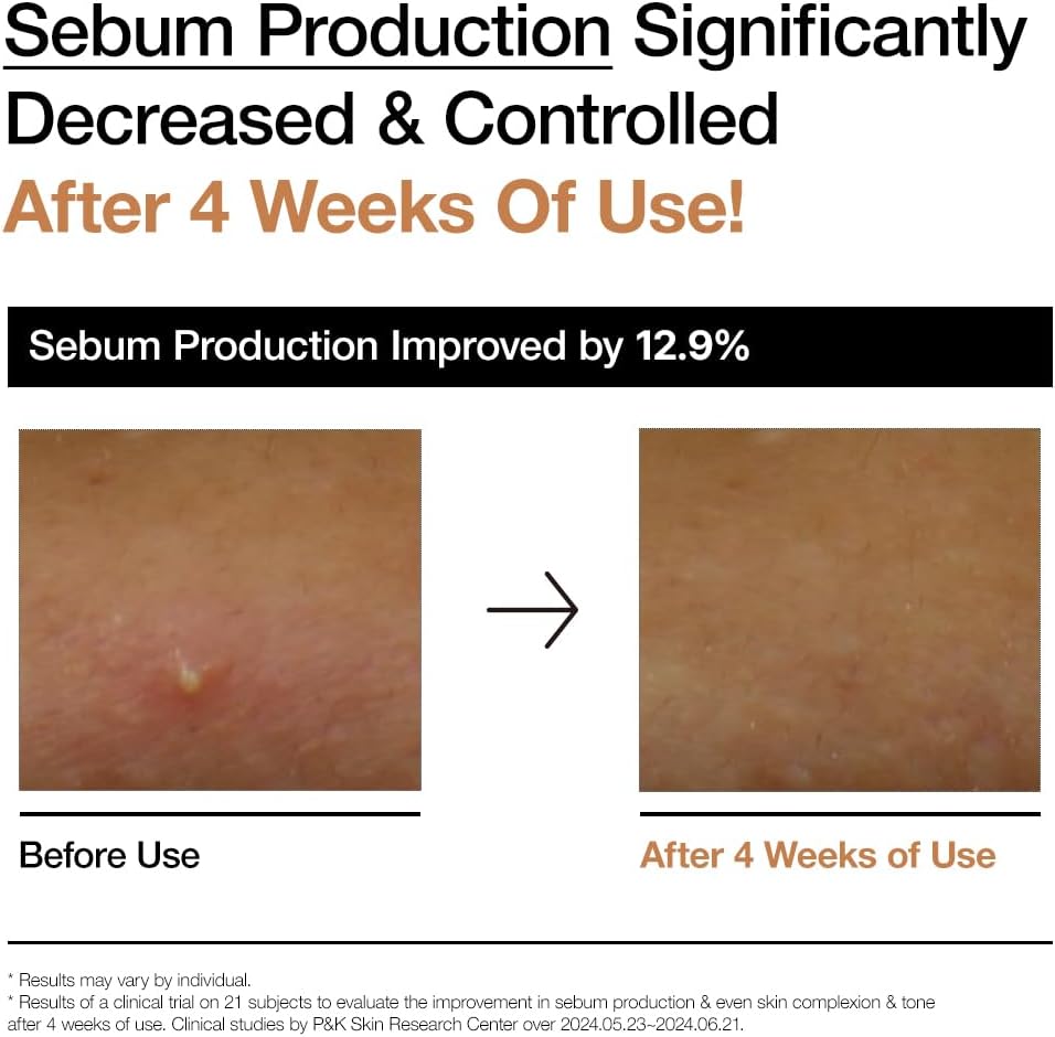 ANUA Rice 70 Glow Milky Toner, for Glass Skin