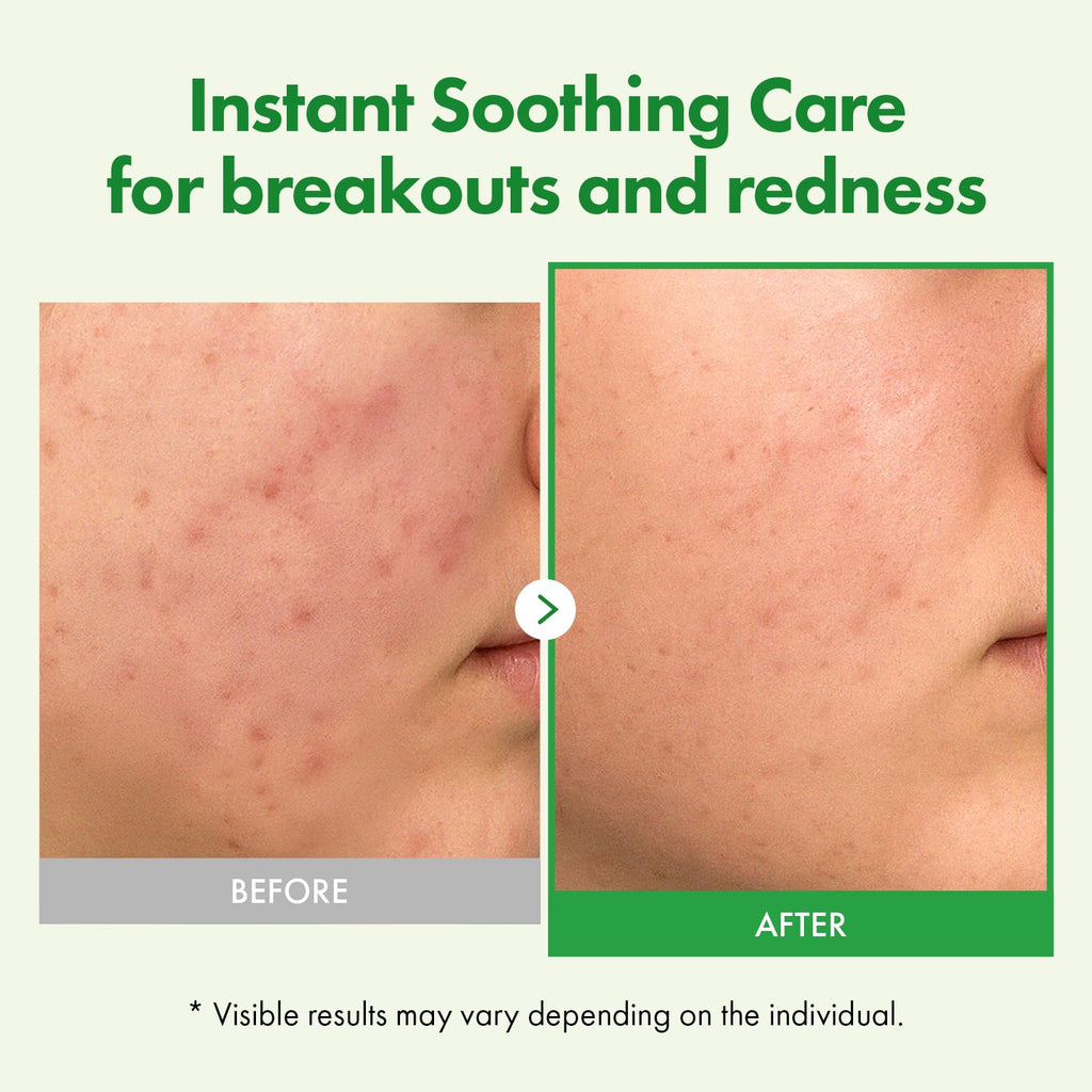 TOSOWOONG PDRN Collagen Jelly Cream, 5,000ppm Salmon DNA PDRN, Niacinamide, Hydrolyzed Collagen, Glow, Hydrating, Firming, Uneven Skin Tone, No artificial color, Korean Skin Care, 50ml, 1.69 fl.oz.