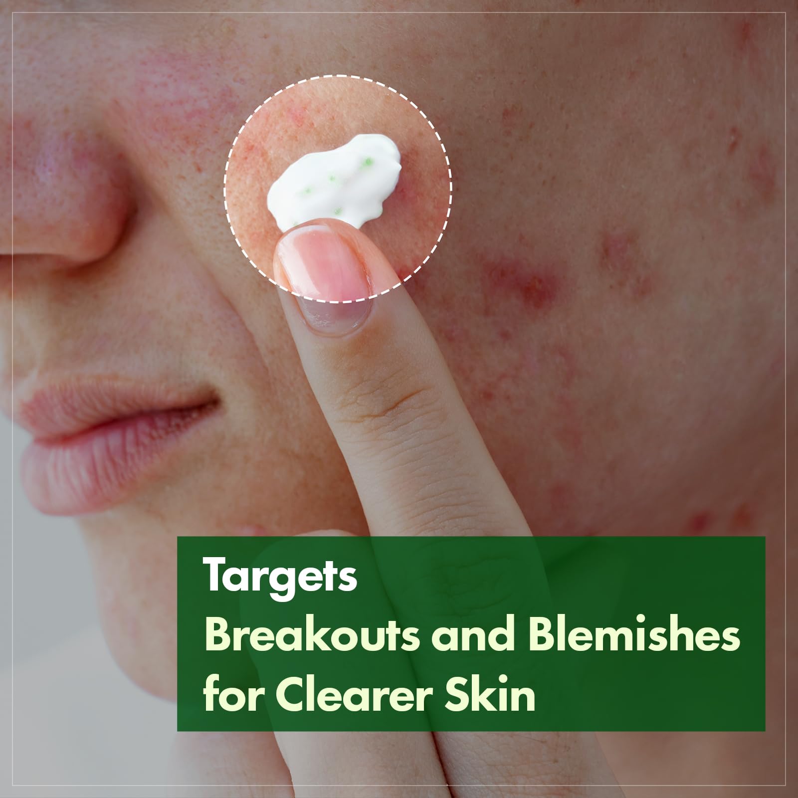 TOSOWOONG PDRN Collagen Jelly Cream, 5,000ppm Salmon DNA PDRN, Niacinamide, Hydrolyzed Collagen, Glow, Hydrating, Firming, Uneven Skin Tone, No artificial color, Korean Skin Care, 50ml, 1.69 fl.oz.