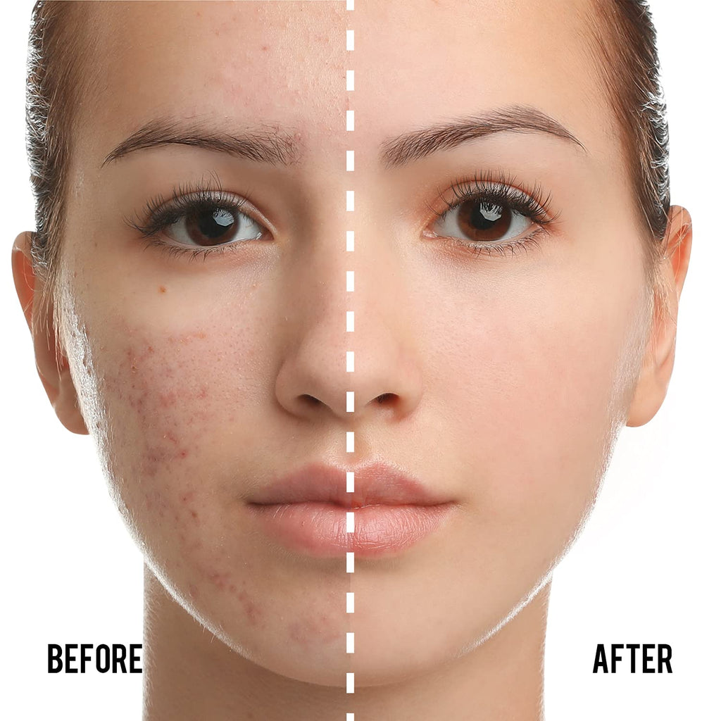 CATKIN Phoenix Cushion Foundation Buildable Coverage Anti-Aging Makeup, Sheer Finish, Refill Included, Natural Beige 0.46 Oz x 2 (Natural Coverage (Light Beige)