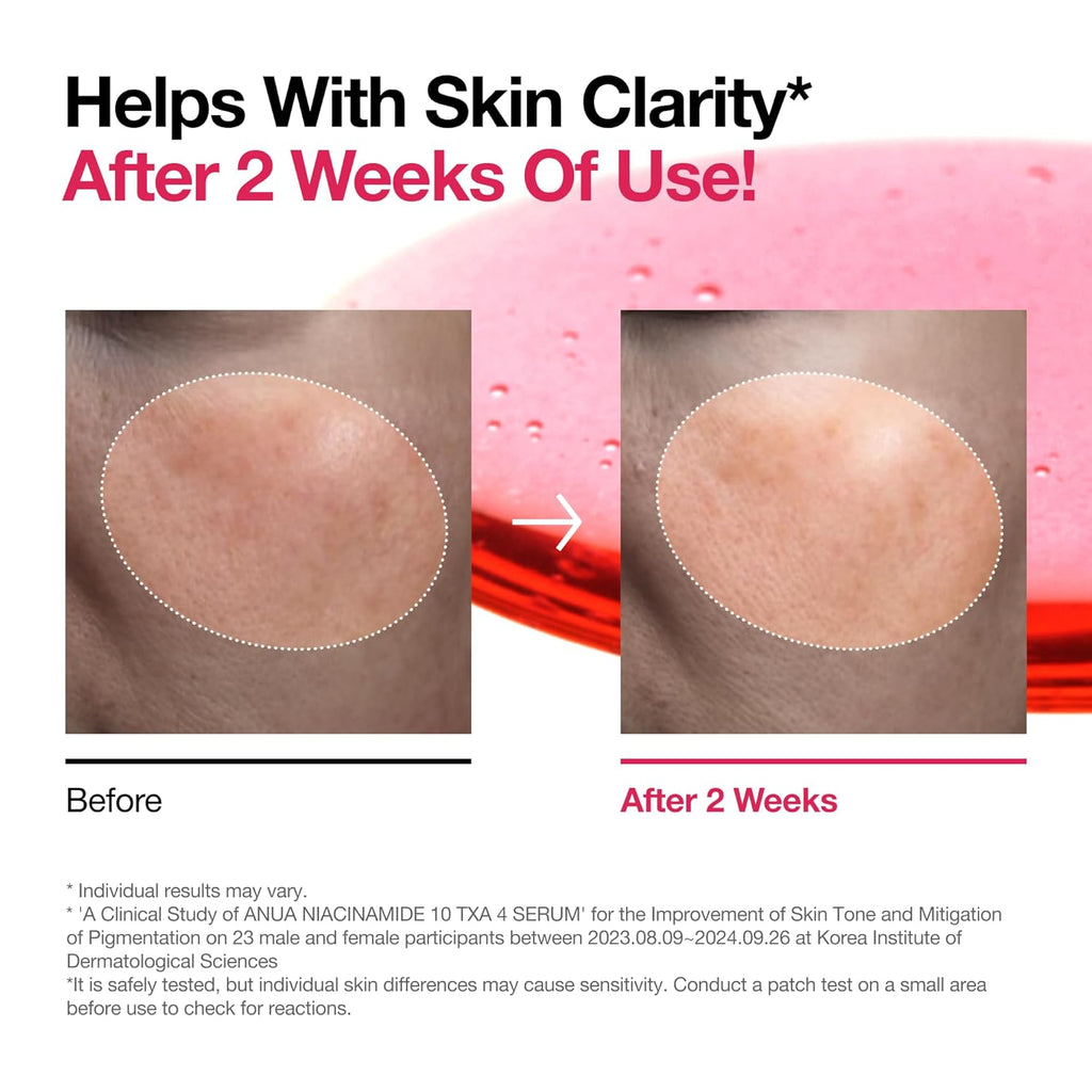 ANUA Niacinamide 10 + TXA 4 Serum