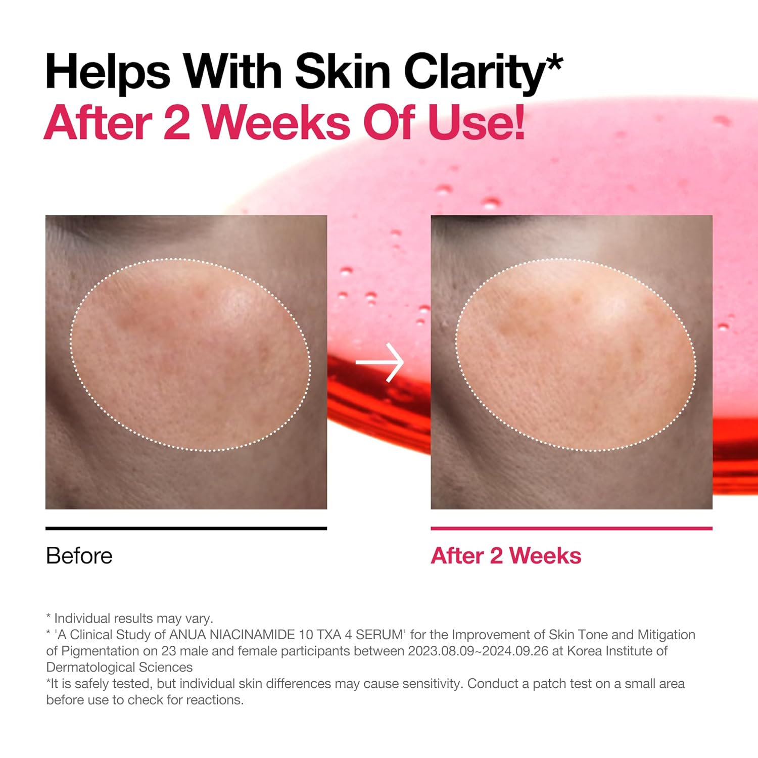 ANUA Niacinamide 10 + TXA 4 Serum