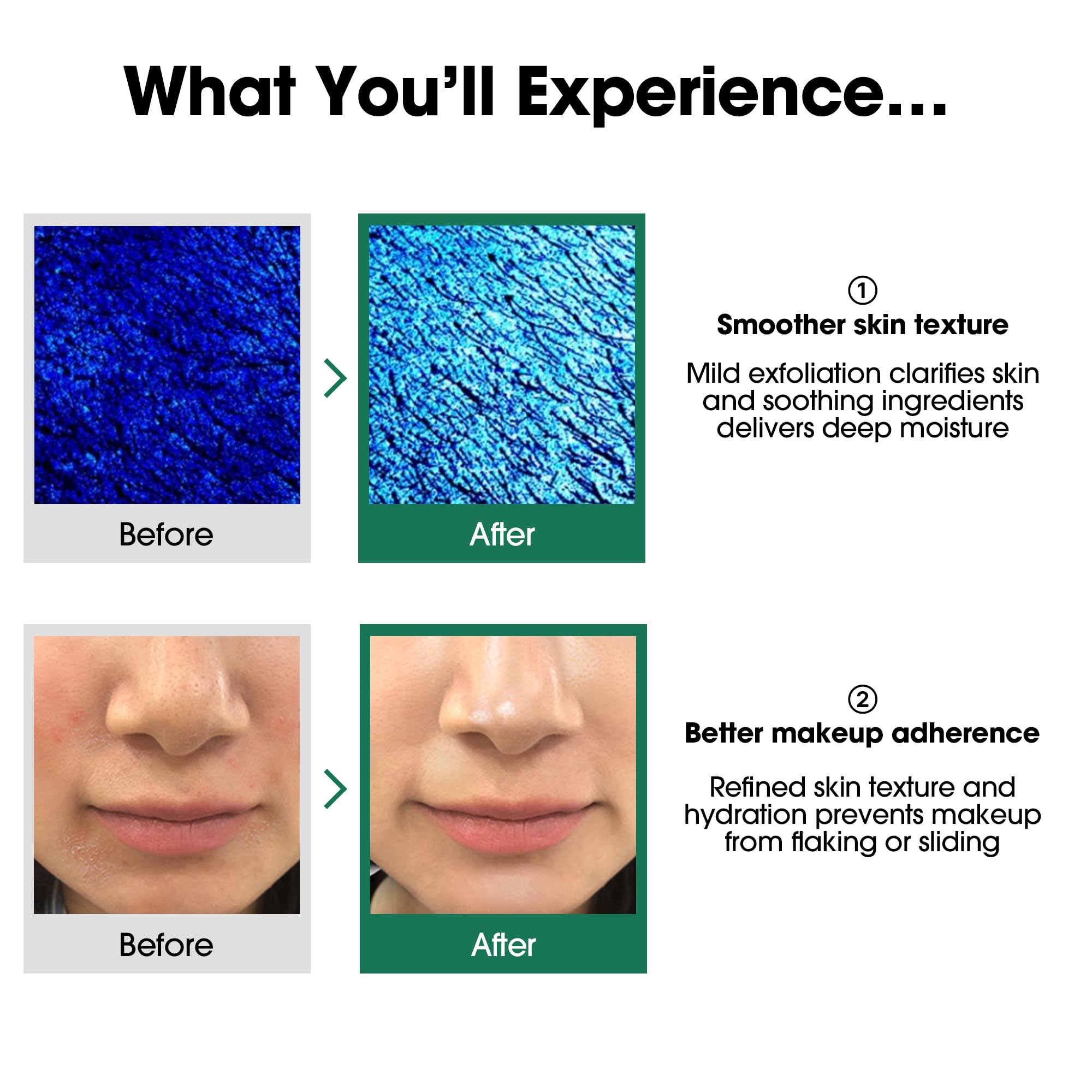 SOME BY MI AHA BHA PHA 30 Days Miracle Toner – 5.07oz, 150ml – Korean Salicylic Acid Exfoliating Face Toner for All Skin Types – Daily Pore Care & Oil Control with 2% Niacinamide – Korean Skin Care