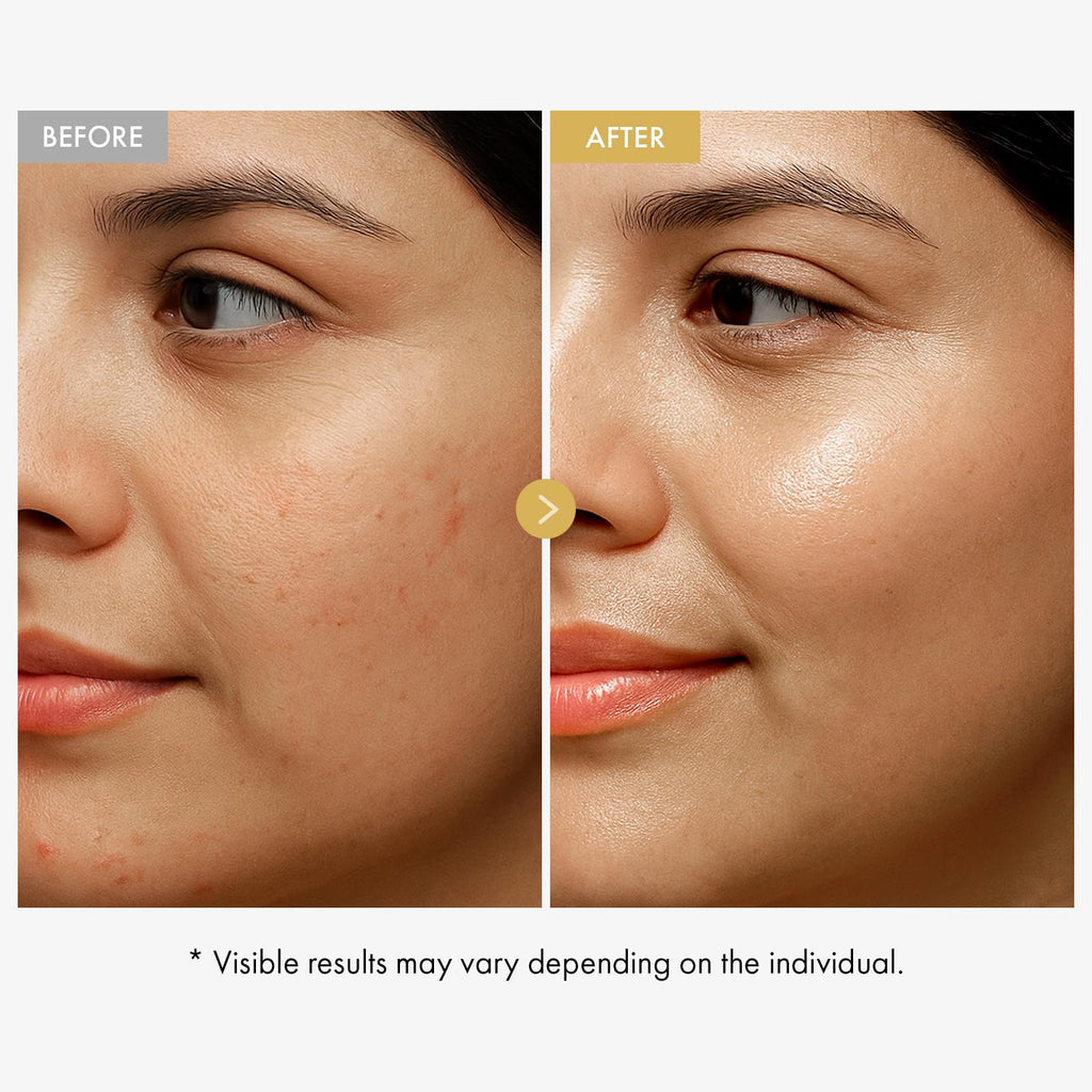 TOSOWOONG PDRN Collagen Jelly Cream, 5,000ppm Salmon DNA PDRN, Niacinamide, Hydrolyzed Collagen, Glow, Hydrating, Firming, Uneven Skin Tone, No artificial color, Korean Skin Care, 50ml, 1.69 fl.oz.