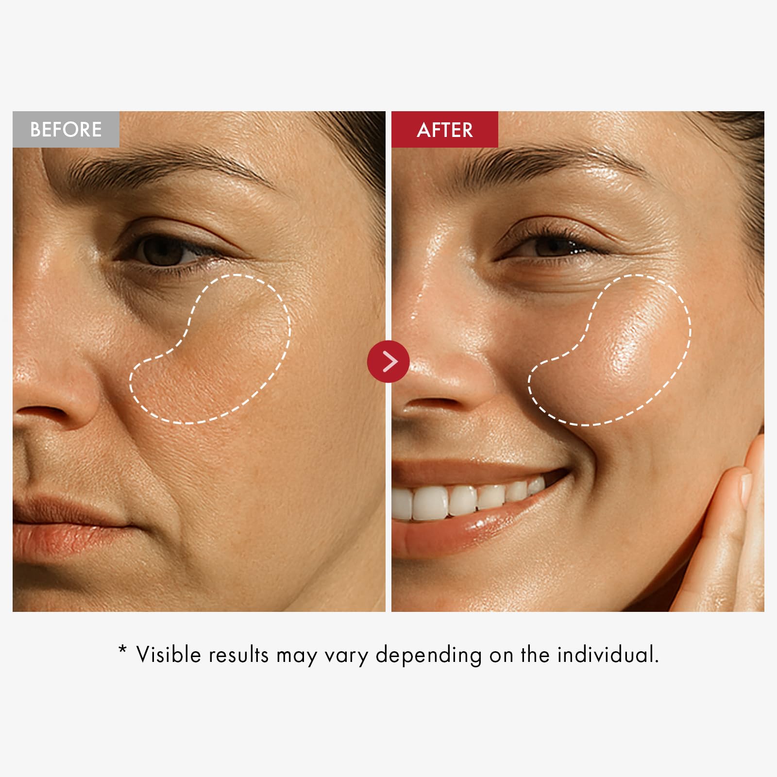 TOSOWOONG PDRN Collagen Jelly Cream, 5,000ppm Salmon DNA PDRN, Niacinamide, Hydrolyzed Collagen, Glow, Hydrating, Firming, Uneven Skin Tone, No artificial color, Korean Skin Care, 50ml, 1.69 fl.oz.