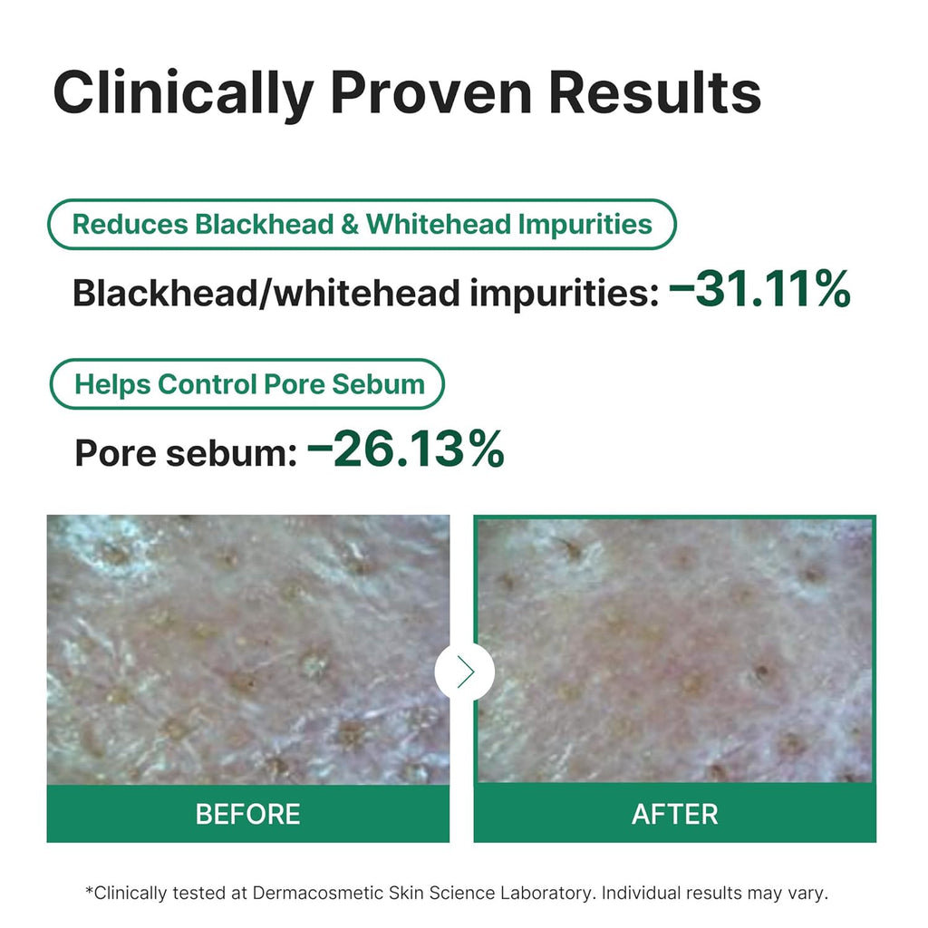 Seaweed Detox Wash Off Mask, Cooling Korean Clay Mask with Bentonite, Kaolin, Glycerin & Seaweed Extracts for Pore Minimizing, Deep Cleansing, Non-Drying Mud Mask, 200ml / 6.76 fl.oz.