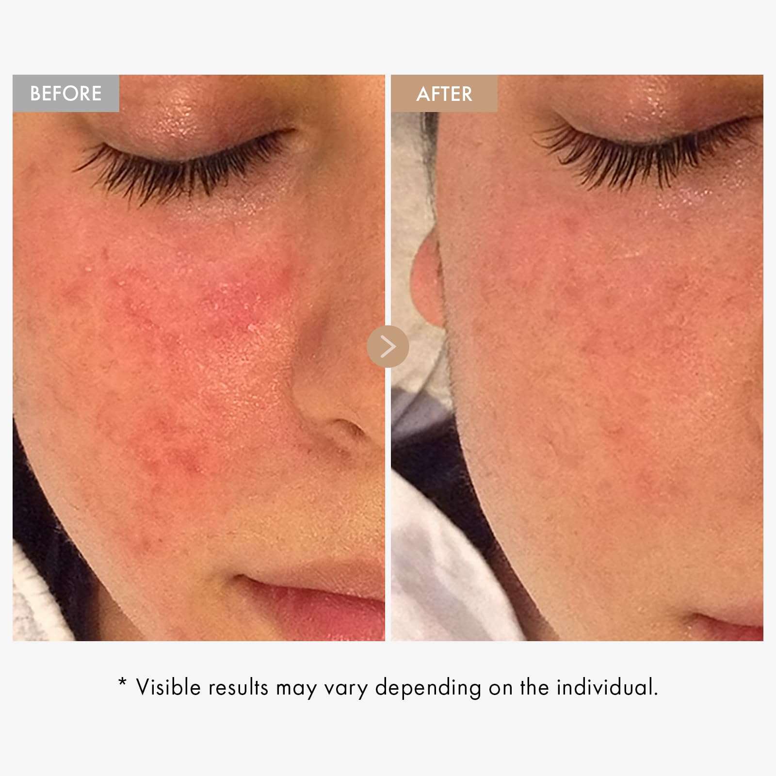 TOSOWOONG PDRN Collagen Jelly Cream, 5,000ppm Salmon DNA PDRN, Niacinamide, Hydrolyzed Collagen, Glow, Hydrating, Firming, Uneven Skin Tone, No artificial color, Korean Skin Care, 50ml, 1.69 fl.oz.