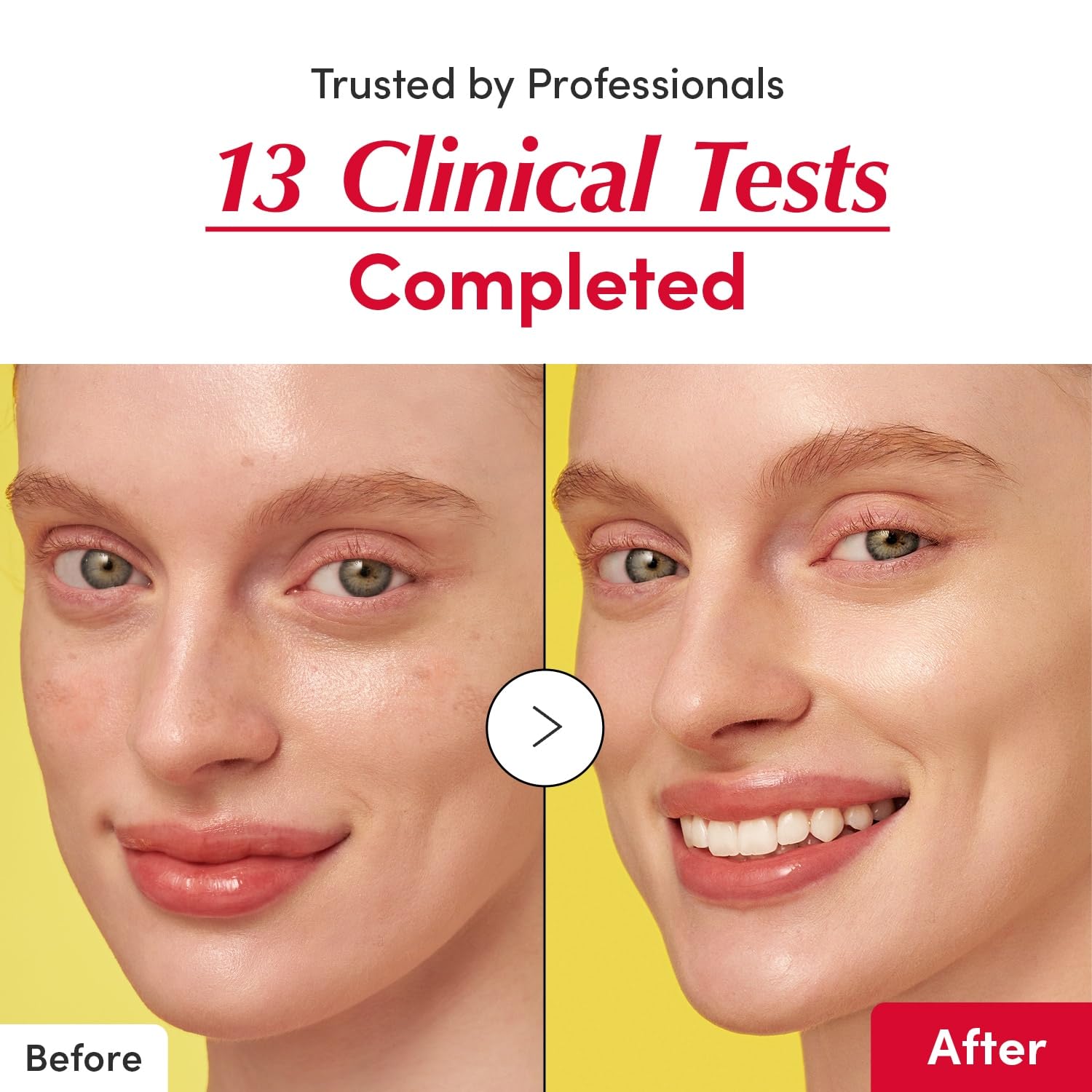 EQQUALBERRY Vitamin Illuminating Serum – Brightening Vitamin C Serum with Niacinamide Strengthens skin barrier