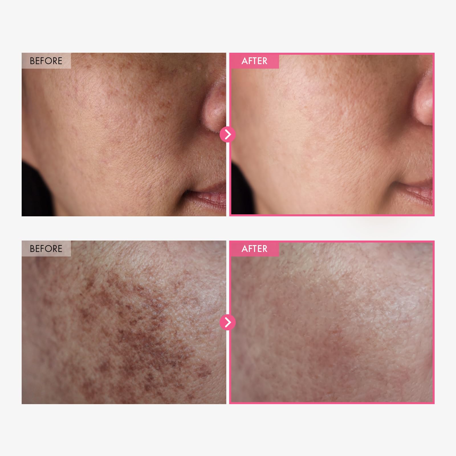 TOSOWOONG PDRN Collagen Jelly Cream, 5,000ppm Salmon DNA PDRN, Niacinamide, Hydrolyzed Collagen, Glow, Hydrating, Firming, Uneven Skin Tone, No artificial color, Korean Skin Care, 50ml, 1.69 fl.oz.