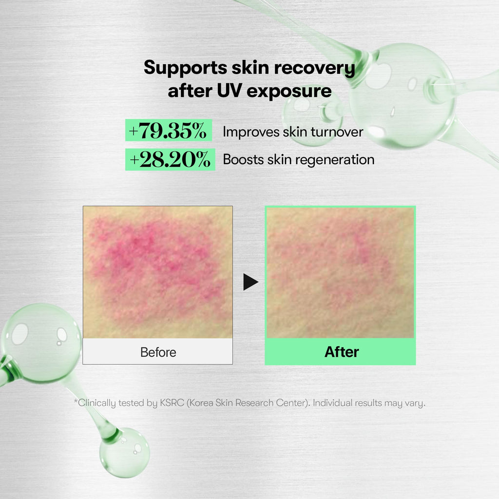 VT COSMETICS CICA Reedle Shot 100, Spicule Microneedling Serum for Pore Care & Exfoliation, Exosome, Centella Asiatica for Glass Skin, Skin Texture, Korean Liquid Skin Booster (1.69 Fl Oz / 50ml)